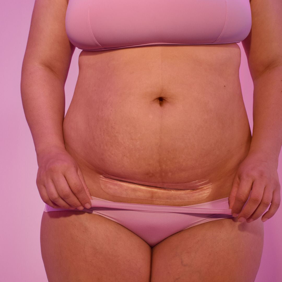 Fridamom® Obliži iz medicinskega silikona za rano po carskem rezu Frida